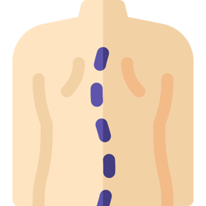 image of scoliosis