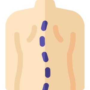 coloured image of scoliosis